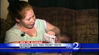 Florida Baby Born With Teeth [upl. by Enelhtak]