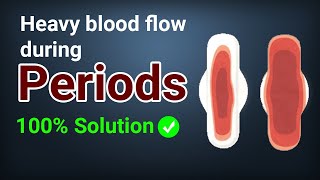 Heavy blood flow during periods  Menorrhagia amp Metrorrhagia  Solution  Rishiraj Ayurvedam [upl. by Tawney]