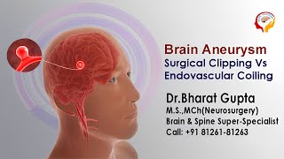 Brain Aneurysm Surgical Clipping Vs Endovascular Coiling I Dr Bharat Gupta [upl. by Adnilam351]