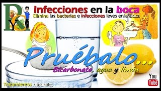 Remedio para las infecciones en la boca elimina las bacterias con limón y bicarbonato de sodio [upl. by Kramlich70]