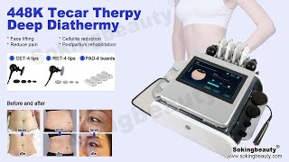 448khz tecar therapy machine  sokingbeauty [upl. by Sisi259]