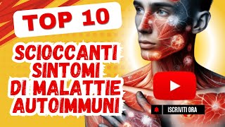 Problemi alla pelle  Sintomi di una malattia autoimmune [upl. by Fabrin617]