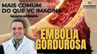 Embolia Gordurosa  Como diagnosticar e tratar [upl. by Pastelki]