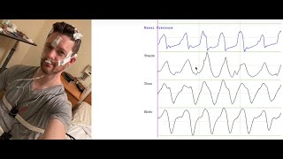 Orientation to Polysomnography [upl. by Ztnarf]