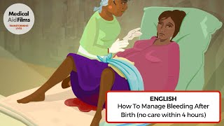 How to manage bleeding after birth no care within 4 hours [upl. by Idahs]