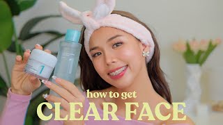 THE BEST SUMMER SKINCARE FOR OILY ACNEPRONE SKIN easy amp effective 💕😳 [upl. by Tanhya217]