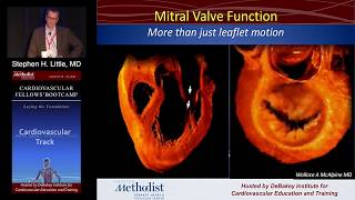 Mitral Stenosis Stephen H Little MD Sunday August 21 2016 [upl. by Augustine]