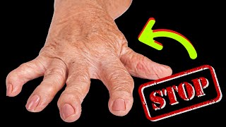 Arthritis Warning NEVER Eat These 8 Foods😱 [upl. by Petersen]