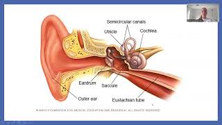 Menieres Disease Presentation [upl. by Mihalco]