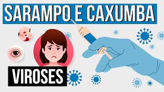 SARAMPO E CAXUMBA tipos de viroses  Resumo de Biologia para o Enem  Cláudia de Souza Aguiar [upl. by Ymeon572]