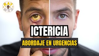 ICTERICIA  ABORDAJE CLÍNICO DE URGENCIAS🚨 [upl. by Aelahs]