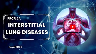 9  Chest Imaging for FRCR [upl. by Eecyak]