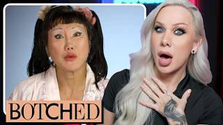 BOTCHED Can transracial plastic surgeries be reversed volume 1 [upl. by Atteram37]