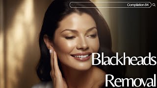 Skincare  Blackheads Removal 084 skincare skincare blackheads blackheads [upl. by Tiphanie718]