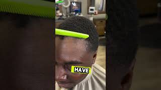 quotRestoring Hairline Before amp After Resultsquot [upl. by Michale]