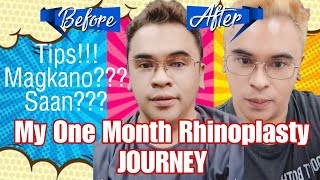 My One Month Rhinoplasty Journey Tips Before amp After Procedure MagkanO ang Gastos sa Rhinoplasty [upl. by Marr]