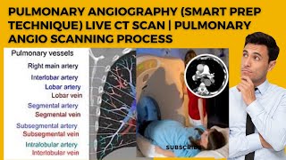 Pulmonary Angiography smart prep technique Live CT Scan  pulmonary angio scanning process [upl. by Nilyram803]