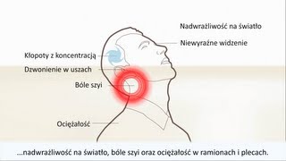 Uszkodzenie kręgów szyjnych  Uraz kręgosłupa szyjnego  Objawy i leczenie [upl. by Beck957]