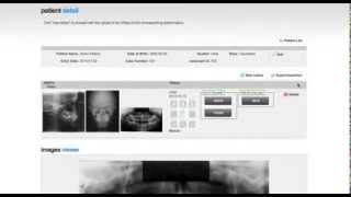 How to enter a New Patient amp Upload XRays into easyceph® [upl. by Coppock]