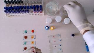 How to check Blood Group  Blood Grouping physiology practical [upl. by Yentyrb]