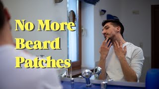 9 Tips for a Patchy Beard [upl. by Aerdma]