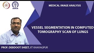 Vessel Segmentation in Computed Tomography Scan of Lungs [upl. by Ermine]