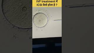 ICSI Procedure in IVF Intracytoplasmic sperm injection fertilitytreatment ivfjourney ivfsuccess [upl. by Htebzile437]