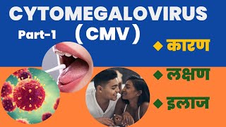 Cytomegalovirus  CMV  Positive l कारण । लक्षण । और इलाज l Part1 [upl. by Grazia]