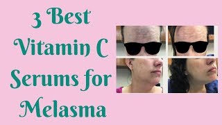 3 Best Vitamin C Serums for Melasma [upl. by Ot960]