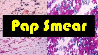 Pap Smear  Pap Test  Pap Smear Procedure  The Role of Pap Smear in Cervical Screening [upl. by Romilly]