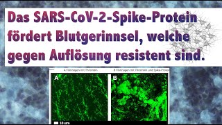 Gerinnselbildung „Clots“ durch SpikeProtein Reaktion auf Studie Blutgerinnung Thrombozyten Clots [upl. by Assereht]