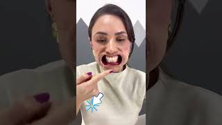 Ultra powerful teeth whitening [upl. by Ycnay]