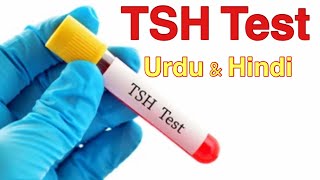 Thyroid Function Test in hindi  Thyroid function test ki रिपोर्ट कैसे पढ़ें और समझें  Normal range [upl. by Izy]