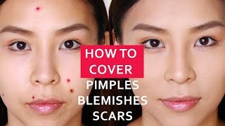 Easiest Way To Cover Spots  Acne  Blemishes  Scars [upl. by Kutchins243]