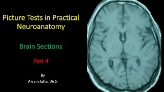 Picture Test in Neuroanatomy Brain Sections 4 [upl. by Ycnay]