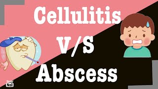 Difference between Cellulitis and Abscess I Cellulitis vs Abscess [upl. by Ahtikal]