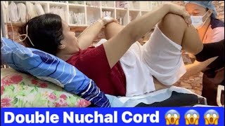 Loud Screaming Mother 😱 Intense Labor And Delivery  Baby Double Nuchal Cord  Hard and Painful [upl. by Jayson]