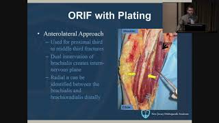 Humeral Shaft Fractures  John Callaghan MD [upl. by Nathanoj97]