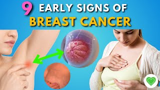 Spotting Breast Cancer Early 9 Warning Signs Every Woman Should Know  Breast Cancer Symptoms [upl. by Norrek]