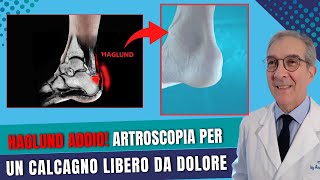 Artroscopia La Soluzione Definitiva per Haglund Tendinite e Borsite [upl. by Aohsoj]