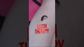 Leech Therapy  Leech biology agriculturebiology leechtherapy shorts ncert science animals [upl. by Azeria]