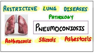 Restrictive Lung Diseases PNEUMOCONIOSIS Anthracosis  Silicosis  Asbestosis pathology robbins [upl. by Strep573]