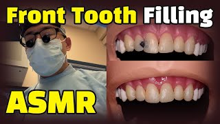 How to fix cavities between front teeth  Dental ASMR Composite Resin Filling Procedure Explained [upl. by Narcho]