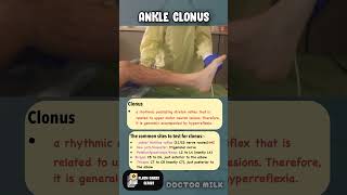 Ankle clonus neetpg usmle [upl. by Taimi]