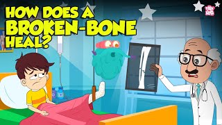 How Bone Fractures Heal  How Does a Broken Bone Heal  Process of Bone Healing  Dr Binocs Show [upl. by Canice]