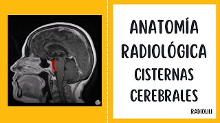 Neuroanatomia Disecciòn Cerebro Cisterna magna Arteria Cerebelosa Posteroinferior PICA [upl. by Aisha421]