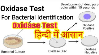 Oxidase test in hindi  Bacterial identification  Microbiology [upl. by Electra]