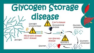 Glycogen Storage Diseases  GSD  Which glycogen storage disorder is most common  pathology of GSD [upl. by Amrita]