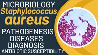 Staphylococcus aureus microbiology  Staph infection  Staphylococcus aureus pathophysiology [upl. by Odlauso]