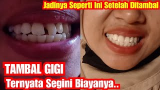 Tambal Gigi Rincian Biaya Dan Hasilnya  How to fill teeth and the cost [upl. by Atihana]